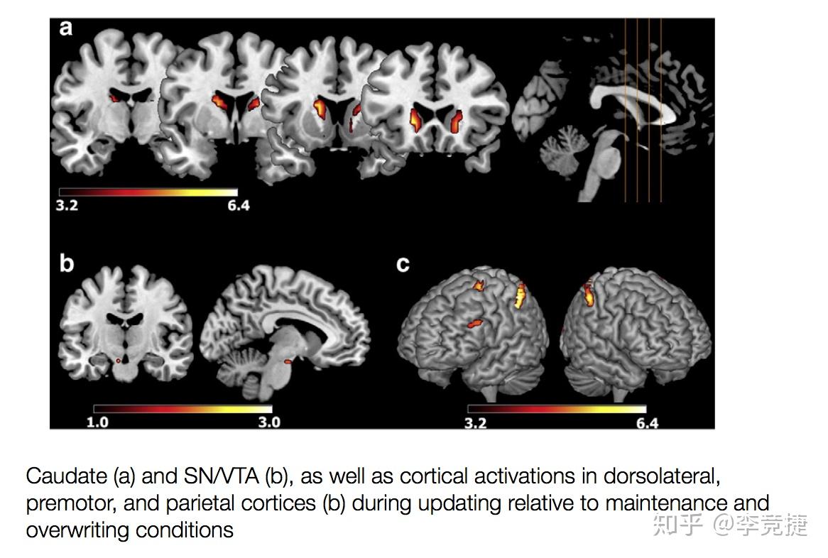 FMRi vs PET: Unraveling the Neuroscience of Brain Function Through Advanced Imaging Techniques