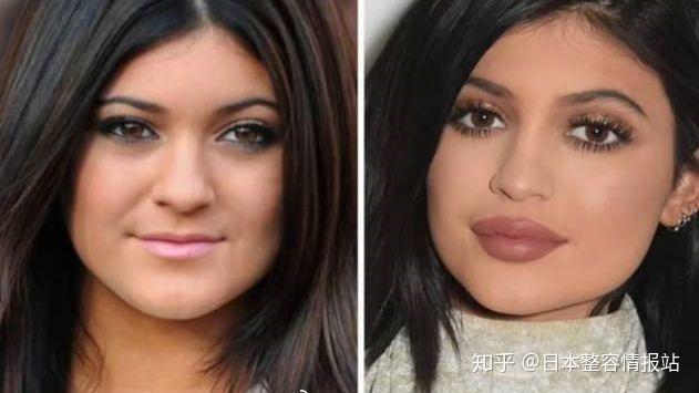 作为真正的顶流网红,她是如何从乡村土妞逆袭成欧美ins脸整容模板的呢