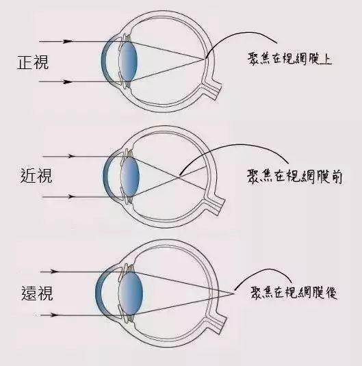 角膜横径图片