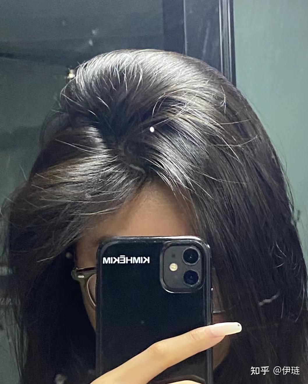 头顶上发缝很大,每天坚持吃维b能让头发变多吗? - 知乎