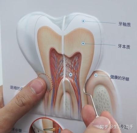 根尖结构图 根尖的结构图简单 根尖的结构示意图