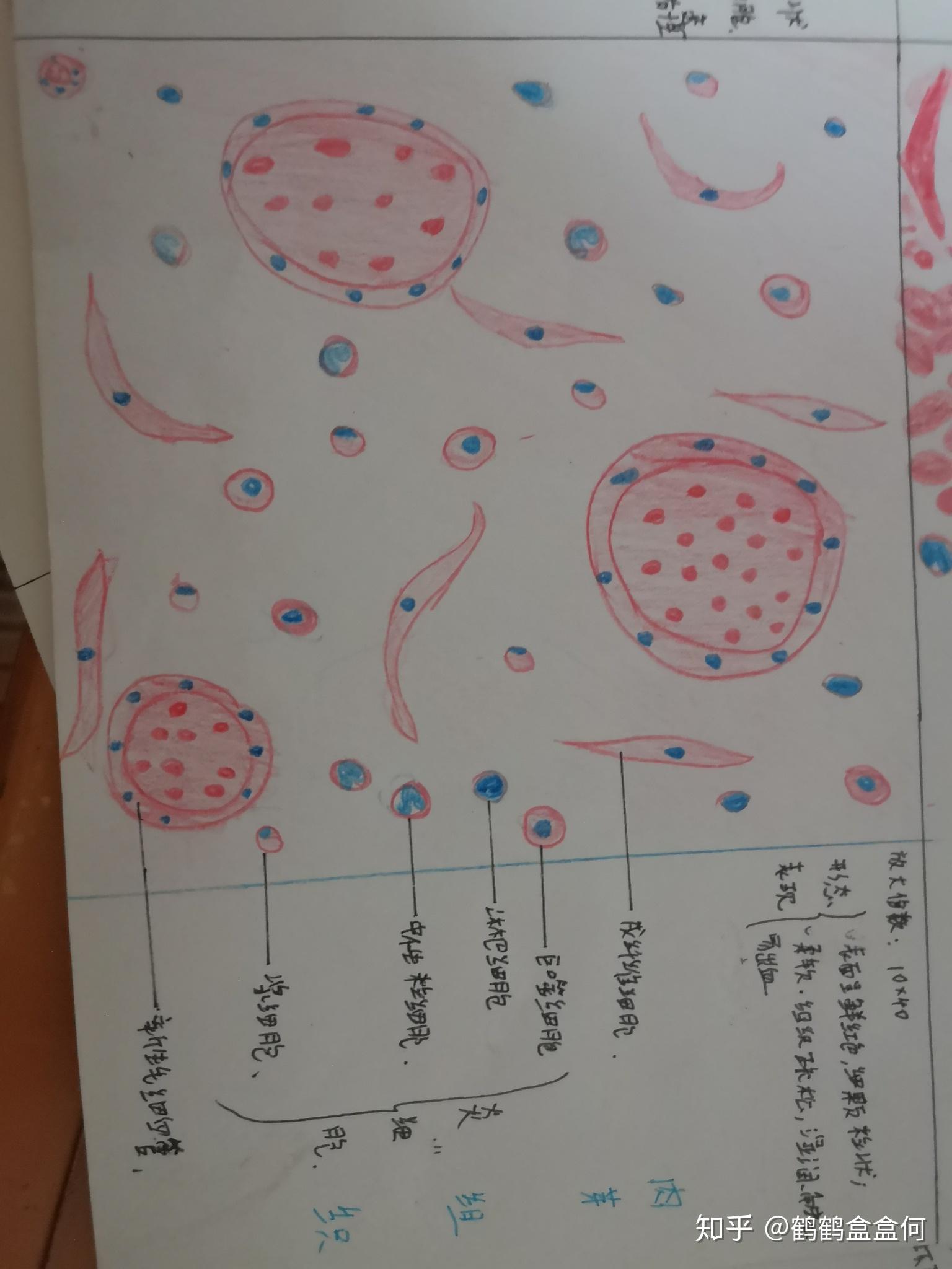 鼻息肉炎症细胞手绘图图片