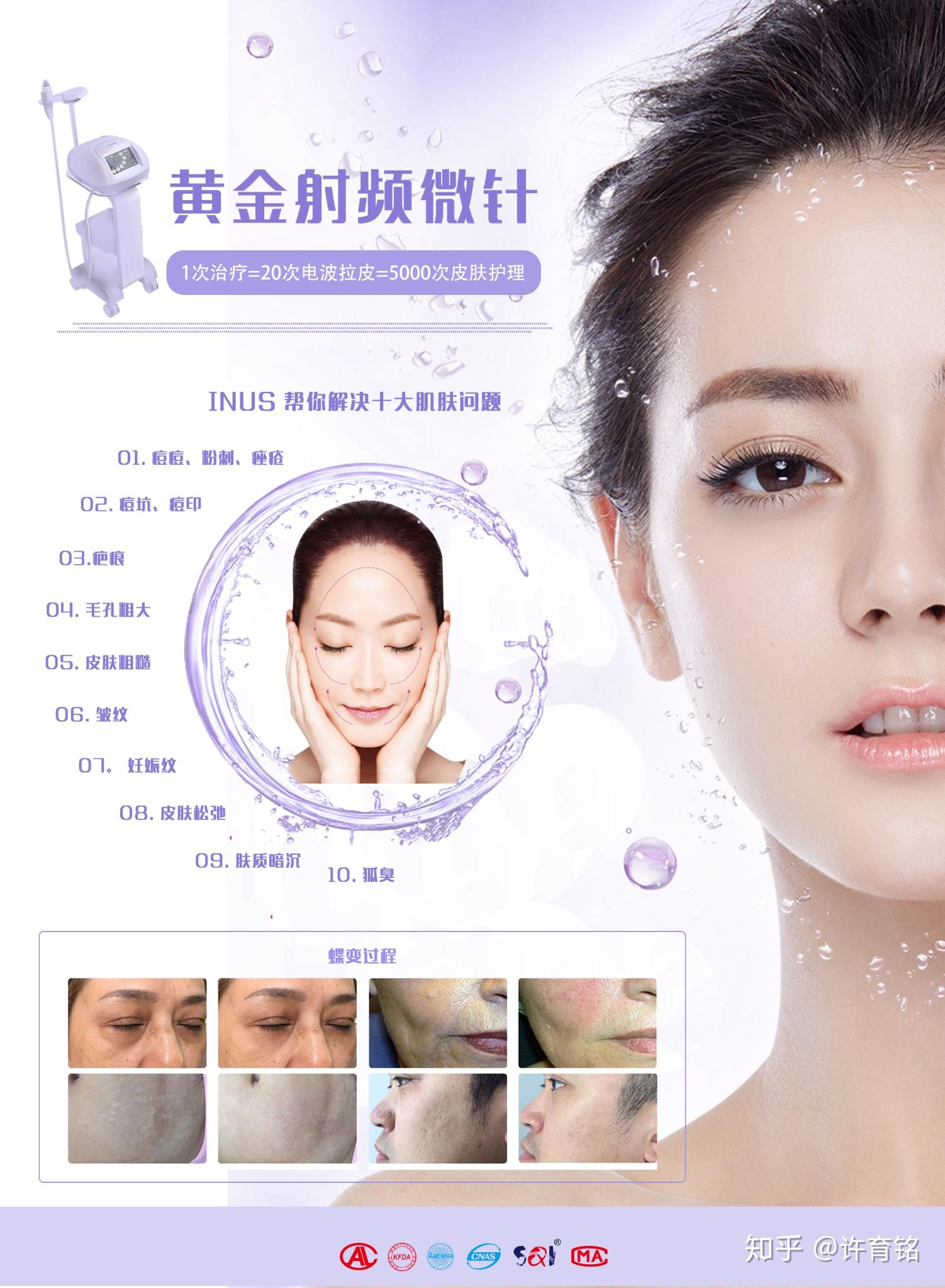 inus黄金射频微针