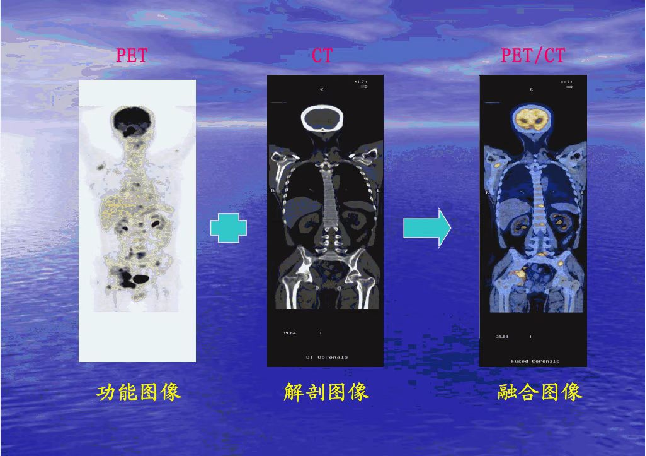 合肥高尚医学影像诊断中心PET/CT正式投入使用! - 知乎