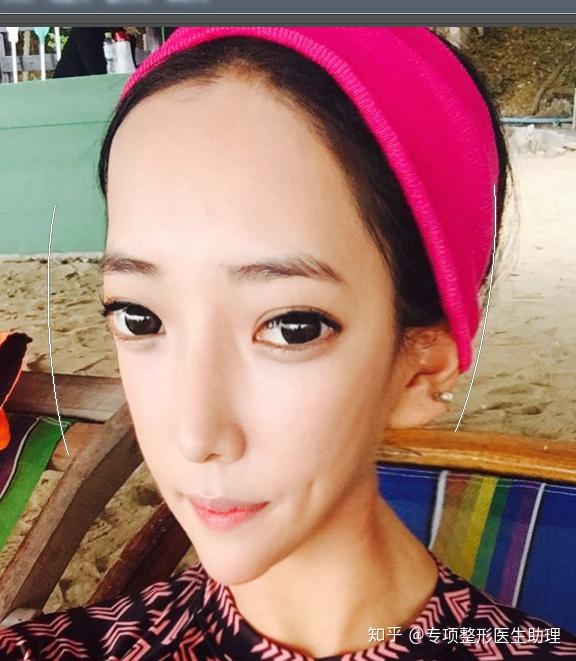 整容脸VS自然脸,到底选哪个?!