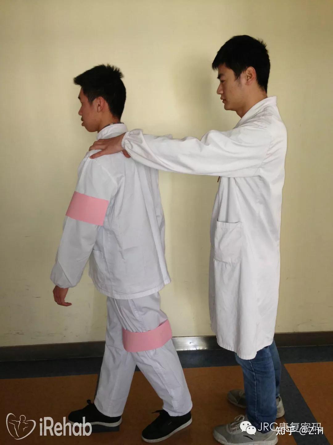 基于Bobath技术的脑卒中患者步行训练 - 知乎