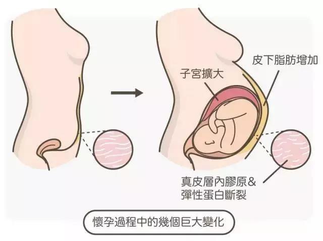 v2-e1ec538d91be07df61e5bf57911952a7_r.jpg