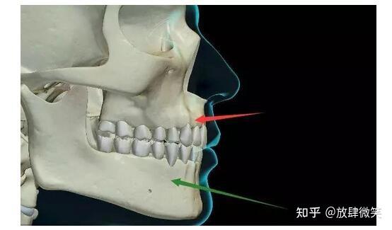 全面解析牙颌面畸形手术