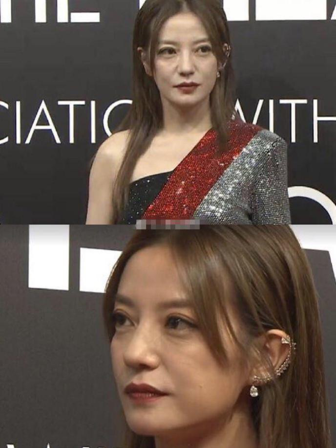 比如说,赵薇皮肤松弛型眼袋的话,可以看到下睑皮肤没有弹性并且松弛