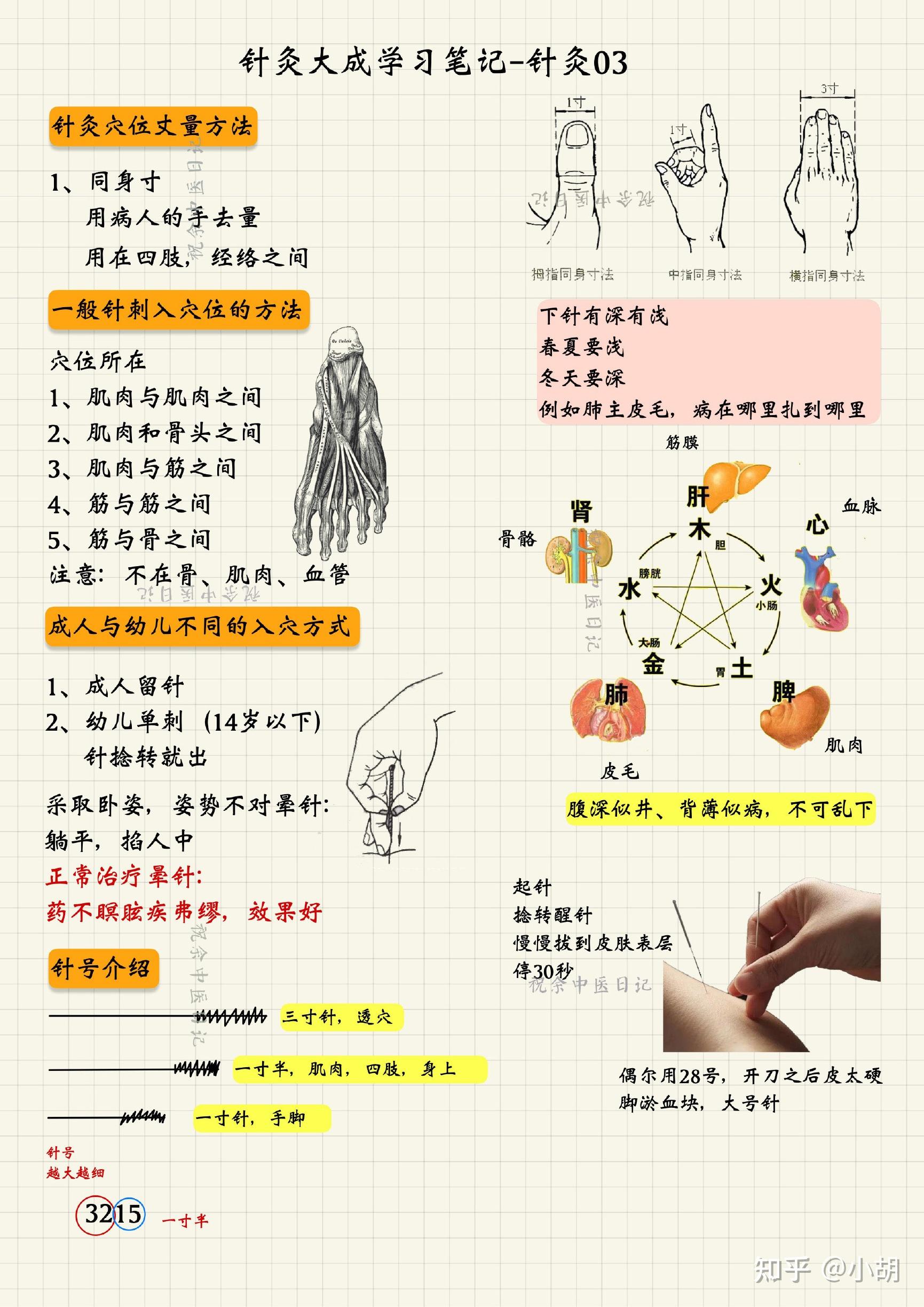 针刺图解十二刺法图片