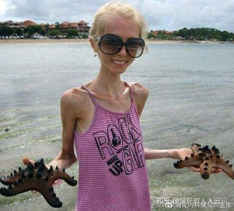 喜欢喝酒而不吃东西的人容易营养不良