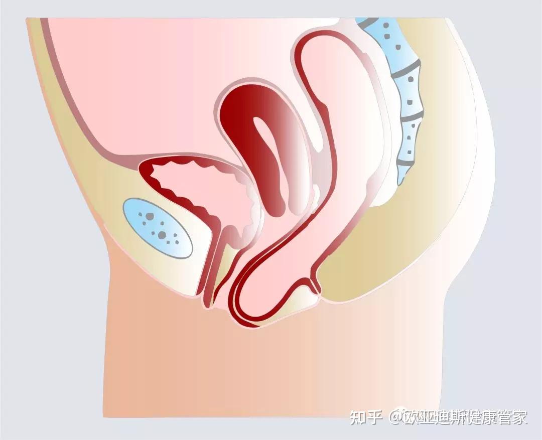 阴壁膨出实拍图片