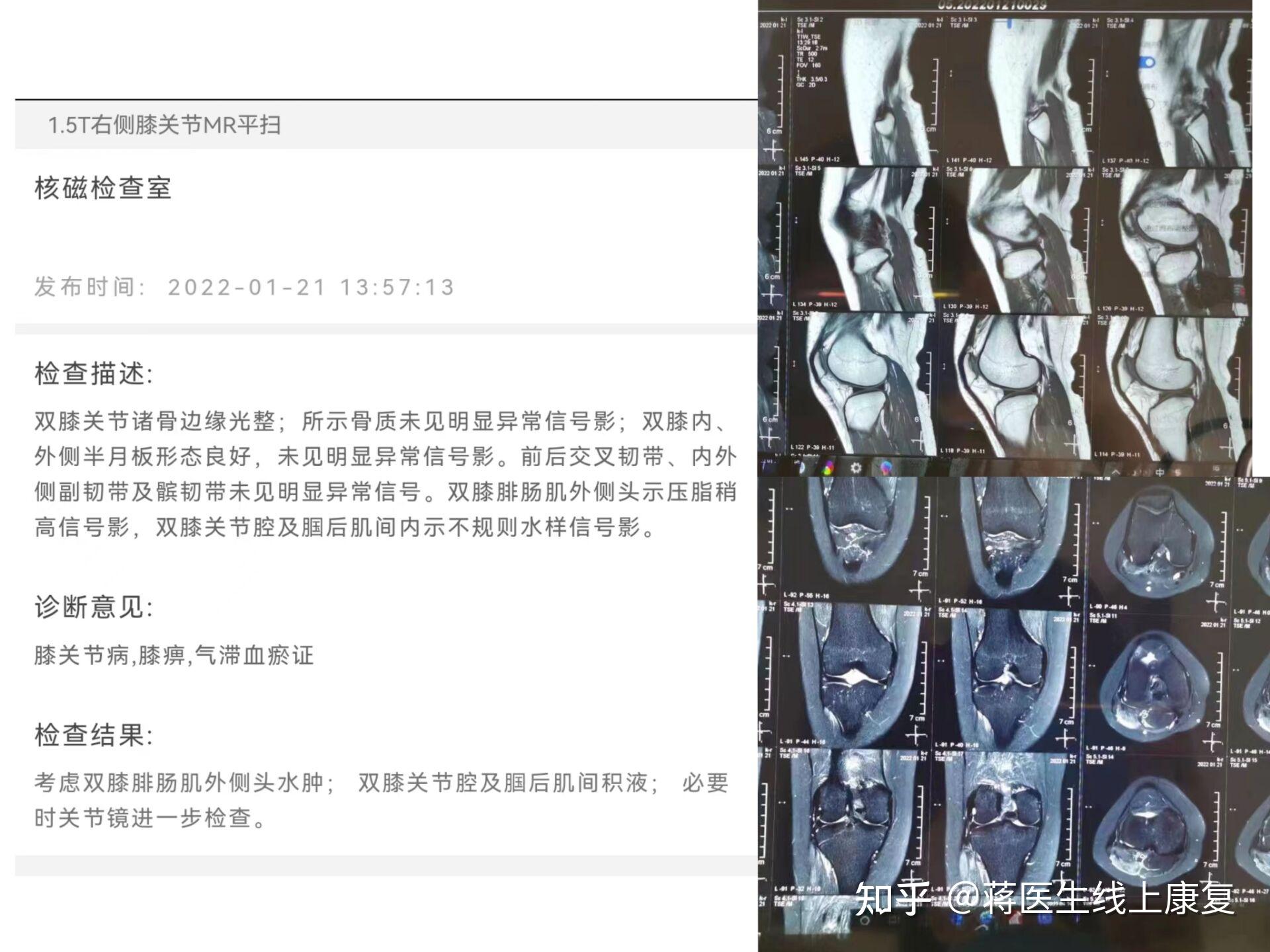 我的热敷经历血泪史:热敷不是万能的,科学热敷很重要! - 知乎