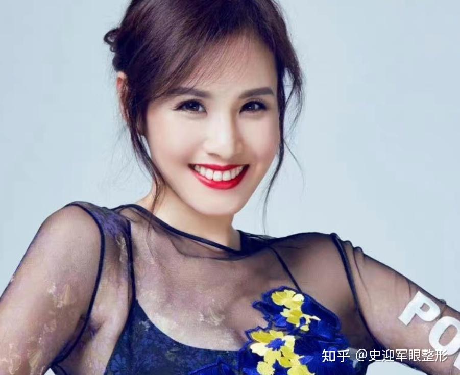 刘畊宏老婆vivi甜笑秘诀在哪