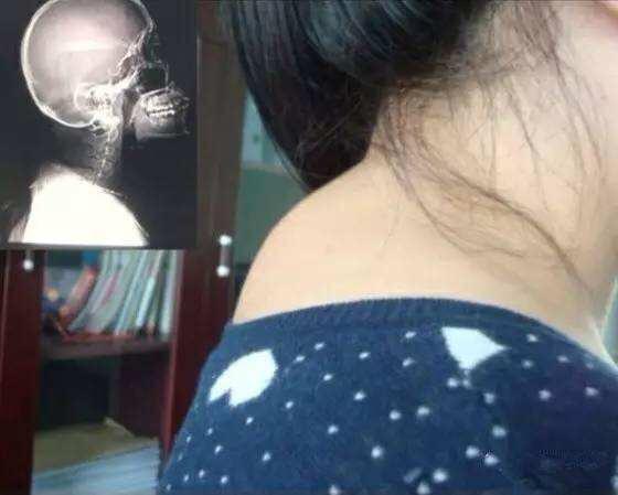 女生如何健身,才能做到穿衣显瘦,形体优美?