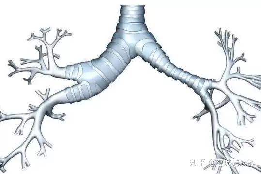 左右支气管图片