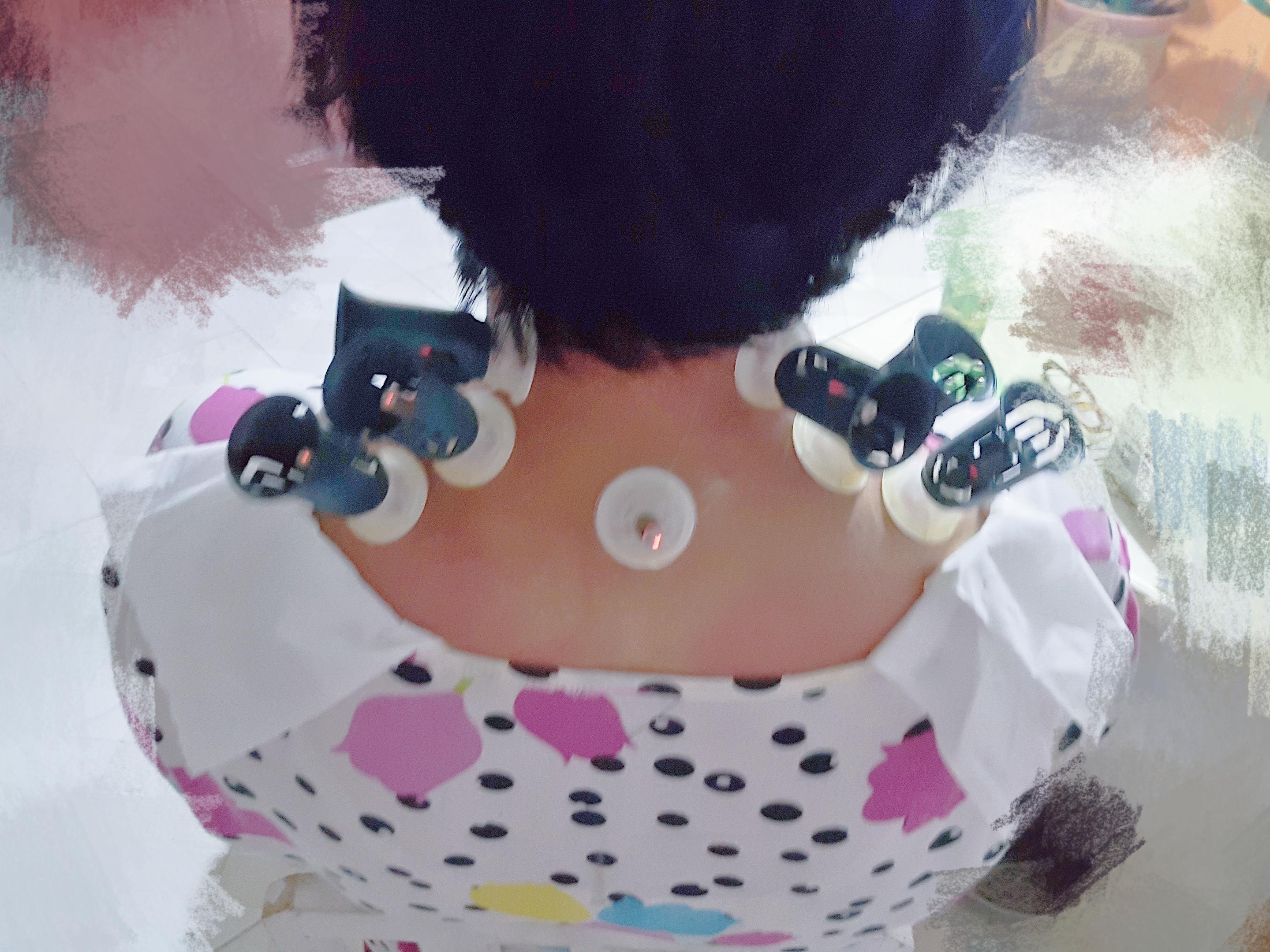 颈椎病 加背痛 六七年了?