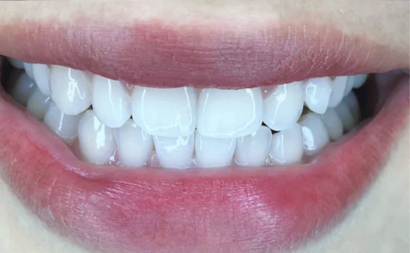 黄牙齿怎么变白最好方法（为什么牙齿会发黄？如何美白牙齿？这2种方法帮助你） | 说明书网