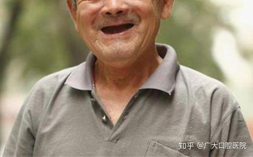 上升趋势部分高龄患者因长期戴假牙致使牙床严重吸收久而久之假牙也戴