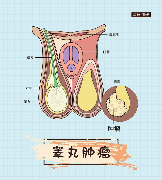 睾丸肿瘤