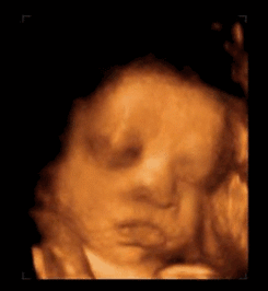 v2-e348b3e6eff63bd7505124fd0e05e2ff_b.gif