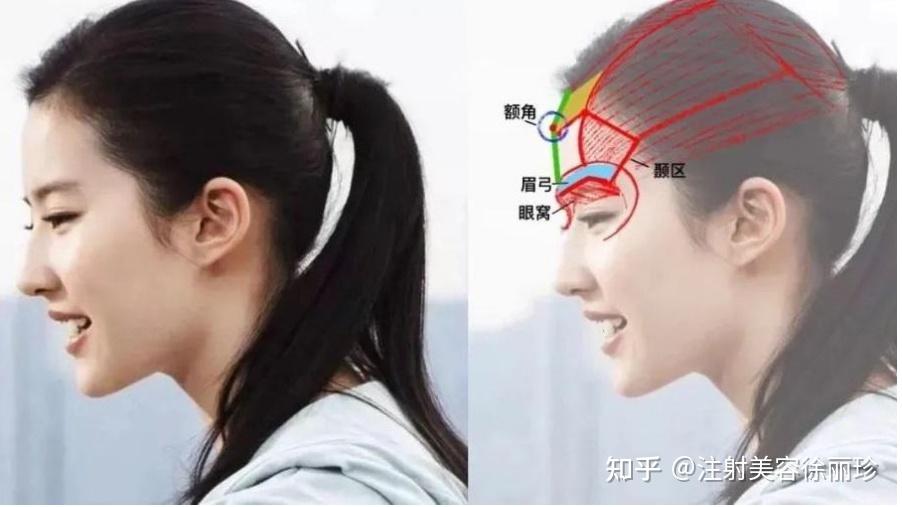 眉弓的艺术,才是影响我们眉形和上面部折叠度的关键 - 知乎