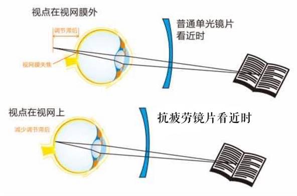 因此,防疲劳镜片的设计原理主要是解决调节功能不足引起的视疲劳,但是