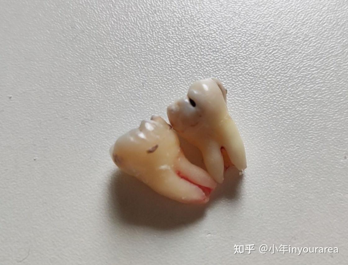 硬生生挺过来(不愧是我)总之,年年哭泣我的造型和这个表情包看起来不