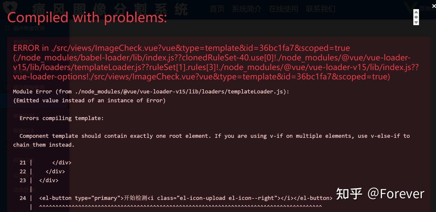 Errors compiling template: Component template should contain exactly ...