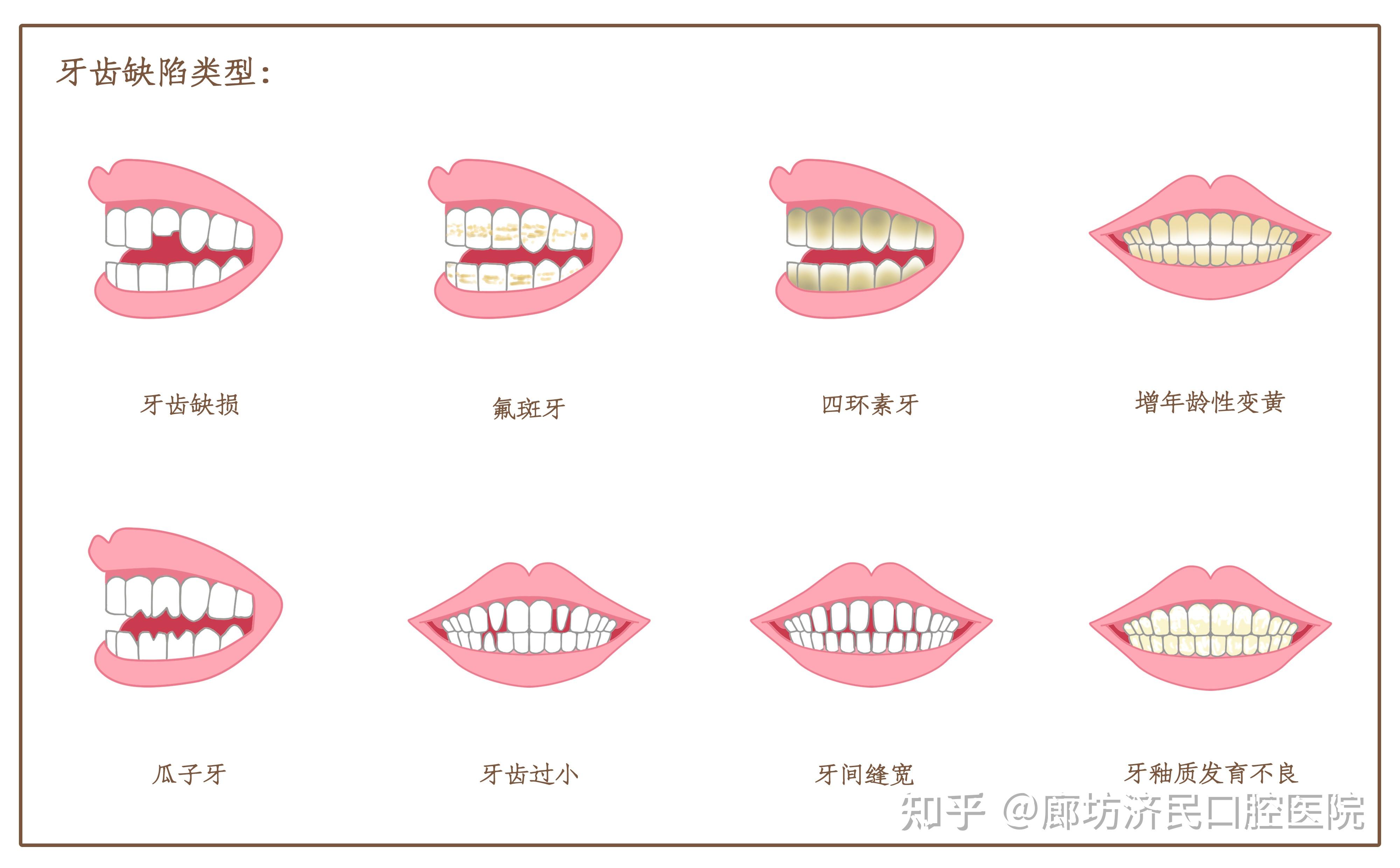 三十几岁还有必要矫正牙齿吗？ - 知乎