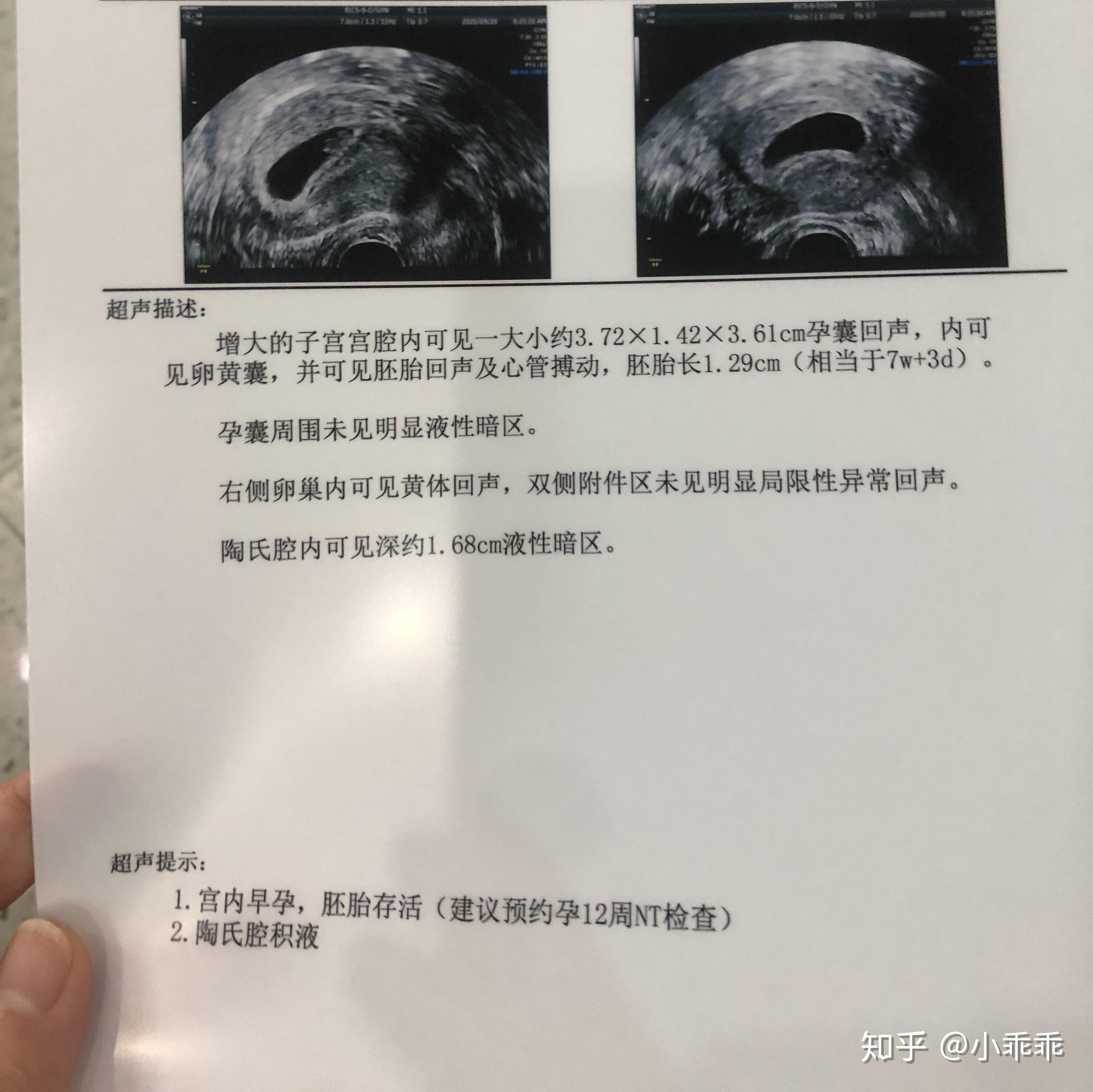 不孕不育之试管之路