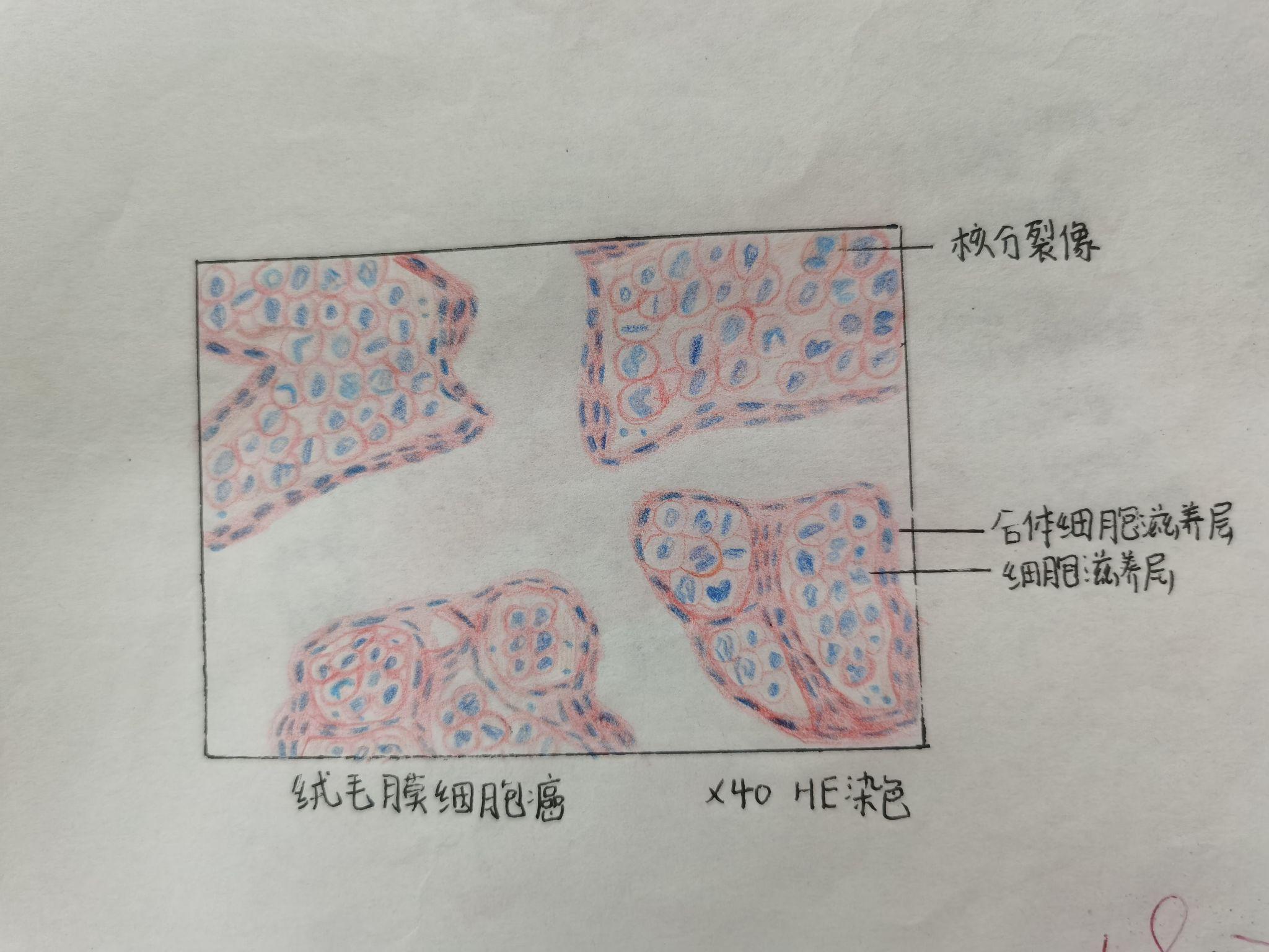 纤维软骨切片手绘图图片