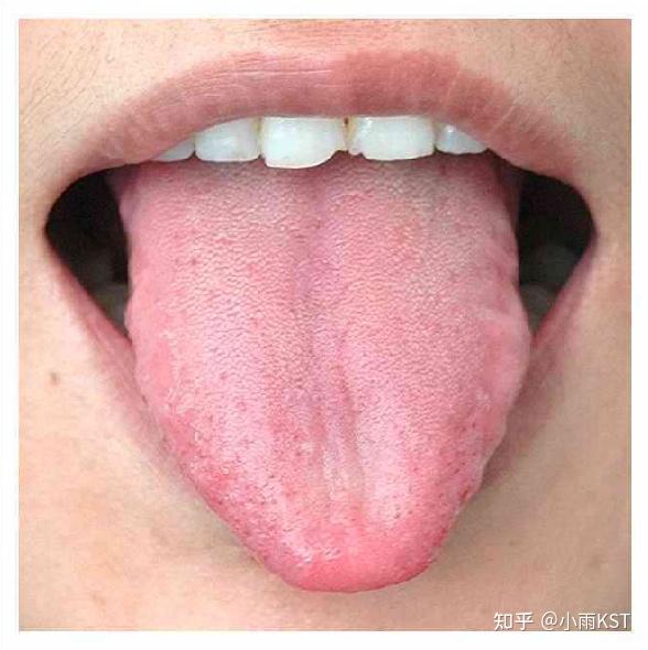 舌质