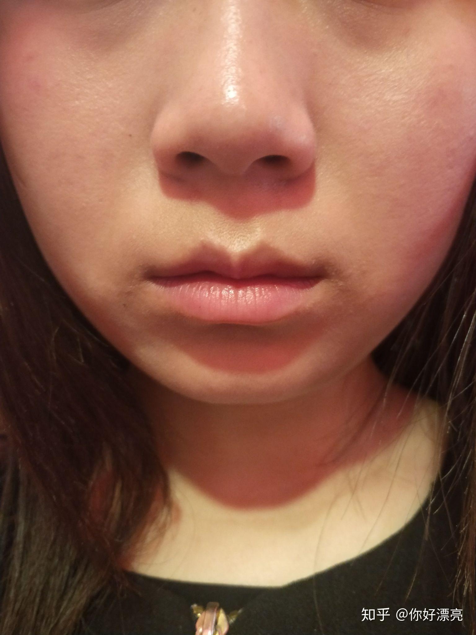 嘴唇不对称怎么办? - 知乎