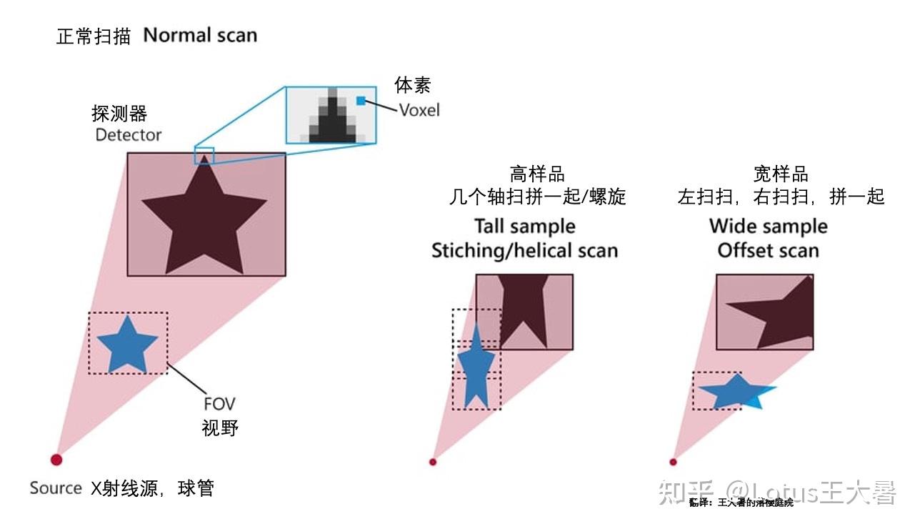 #174 从影像的角度看CT:详解CT的空间分辨率 - 知乎