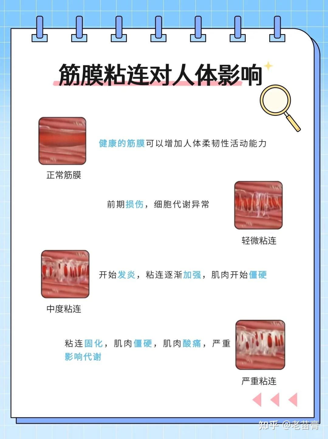 筋膜肌肉粘连怎么快速恢复正常 - 知乎