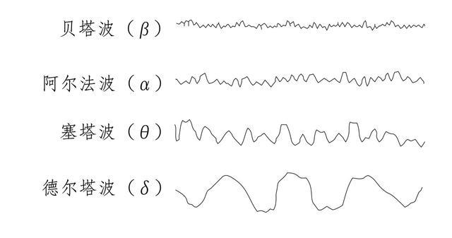 从脑波看睡眠,这些波代表什么?