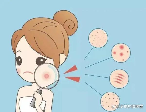 油痘肌、油敏肌？我们该如何区分？ - 知乎