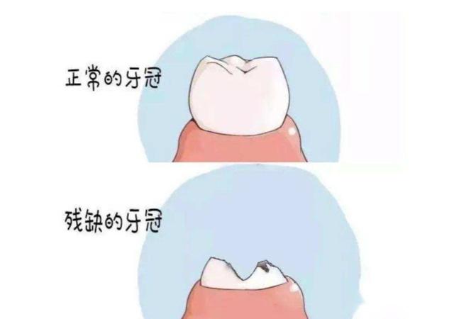 残根牙的牙根牙冠上有少量的残留,且检查牙齿牙根没有松动,敲击也没有