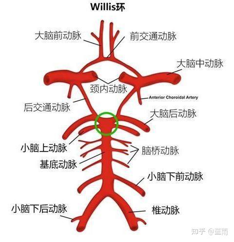 基底动脉尖综合征临床表现及机制 - 知乎