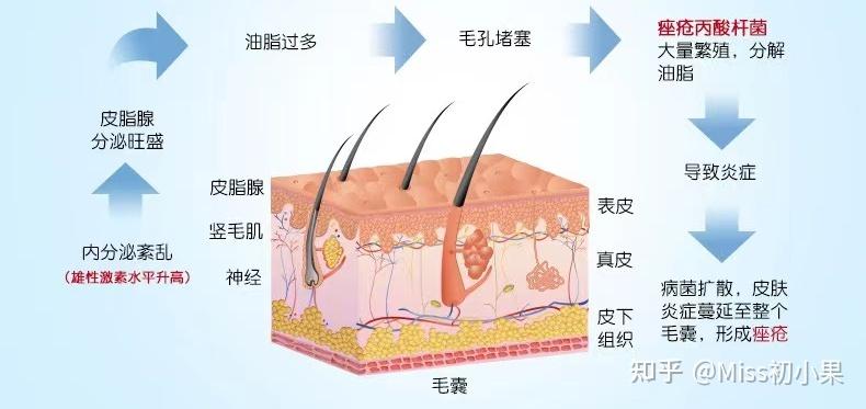 长痘了怎么办只会挤痘痘其实还可以用它