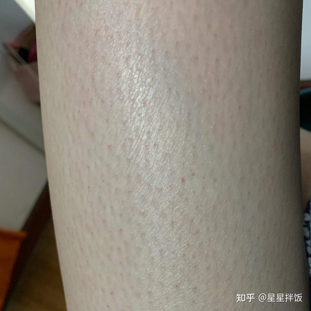 一直用脱毛膏脱毛行吗？ - 知乎