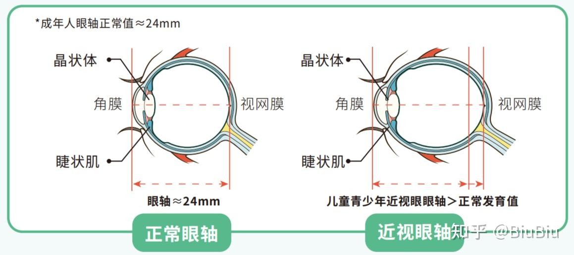 眼轴在哪个位置图片图片