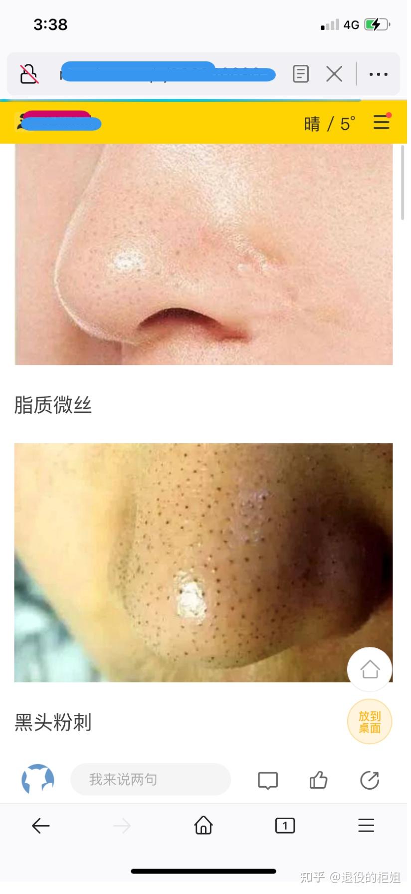 脂质微丝到底是什么