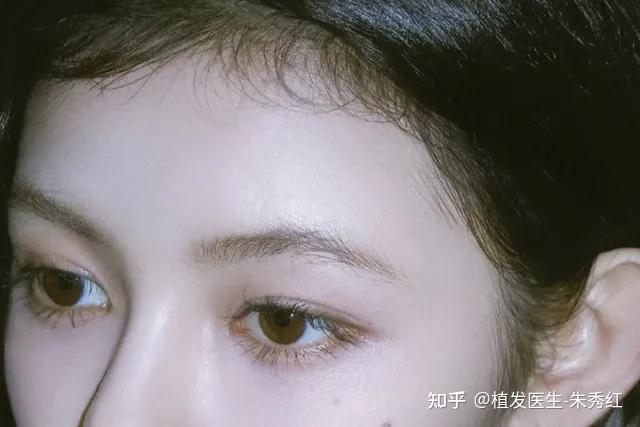 为什么毛流感发际线,会让人看起来很减龄? - 知乎