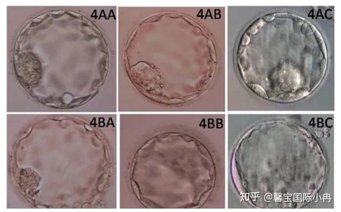 试管婴儿什么是囊胚(试管婴儿移植囊胚是什么意思)-第2张图片-鲸幼网