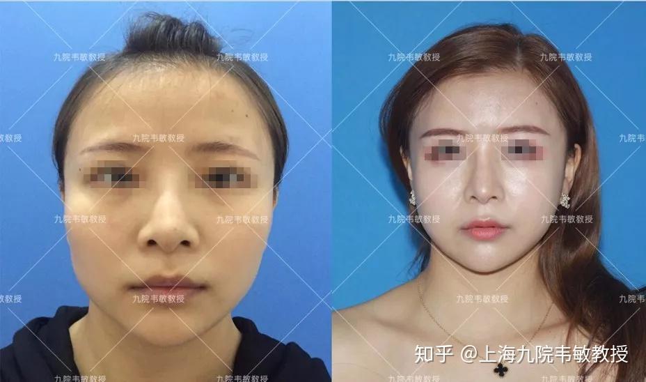 什么是方脸型图片 v2-e6d1fdb32d9d6a8e7931607fae49d4e3_r.jpg