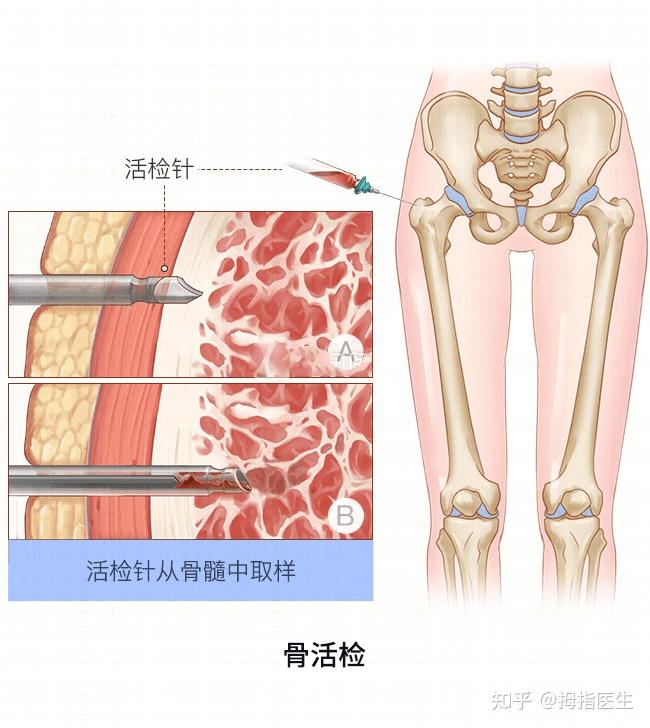 佐串骨位置图片图片