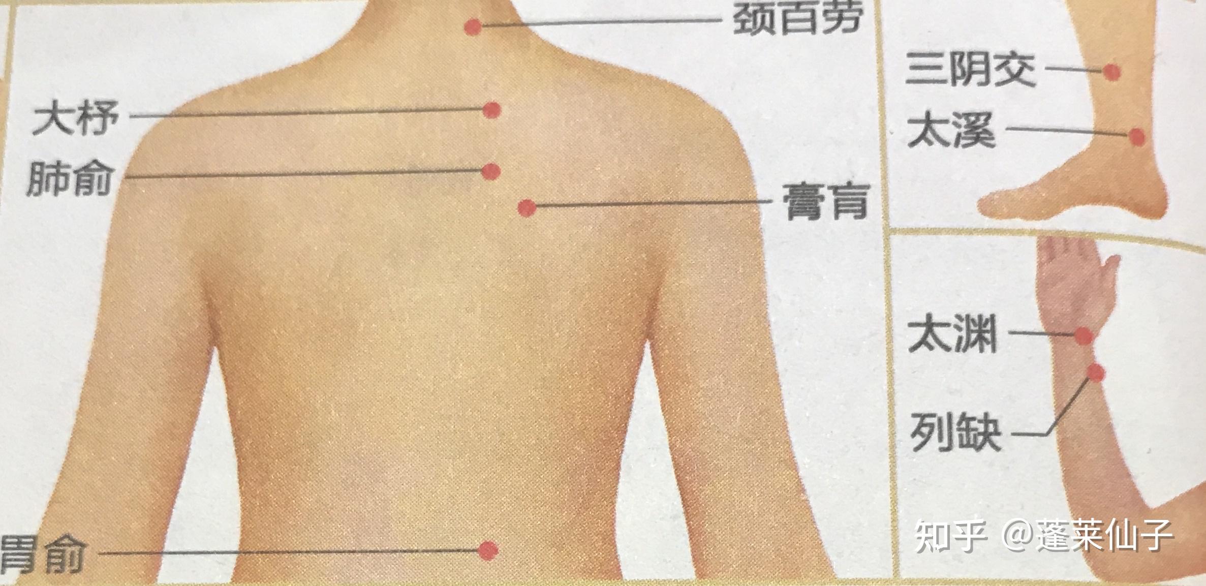 刮痧拔罐治肺结核