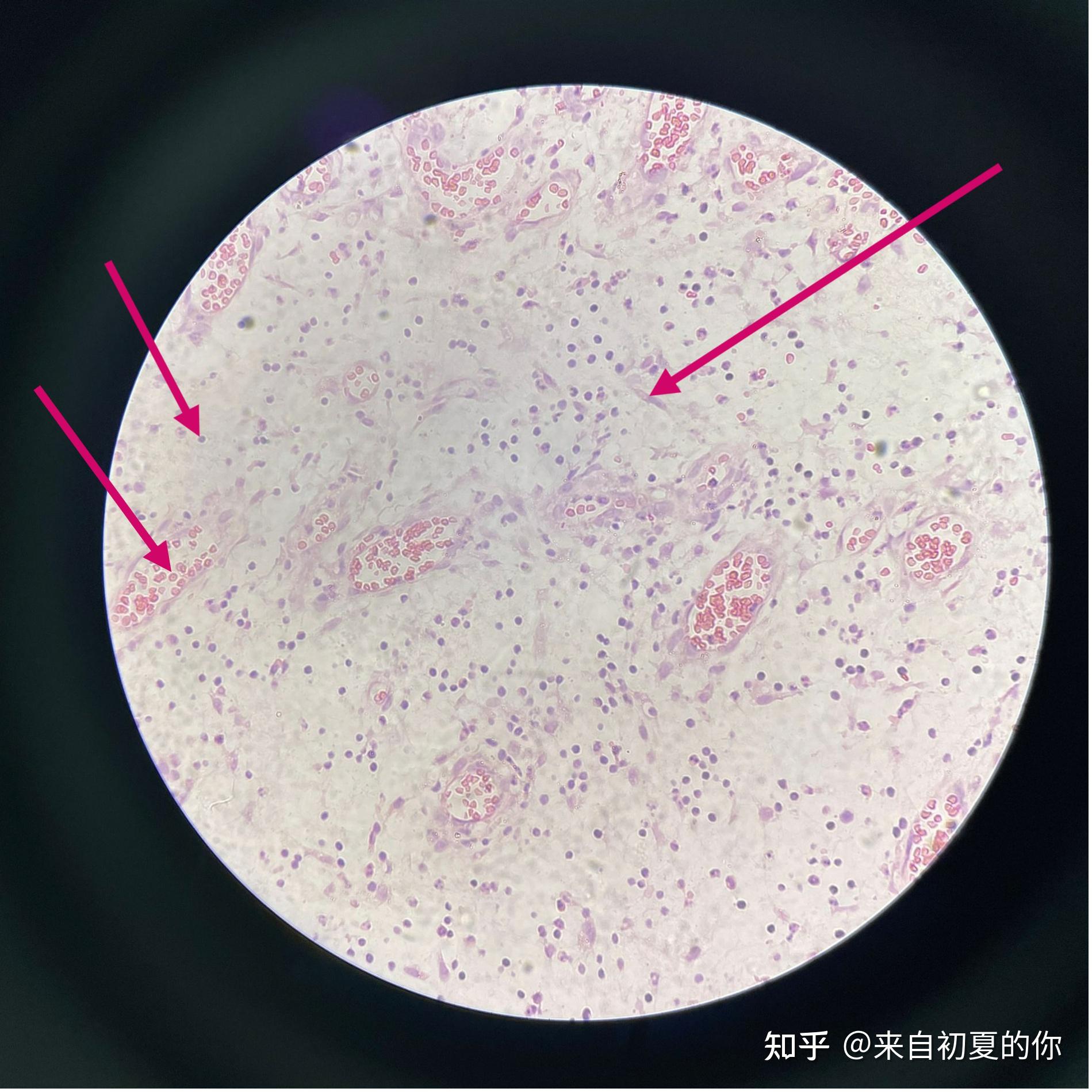 切片干扰图片